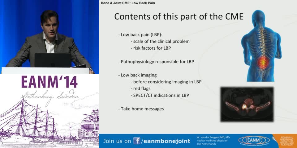 Pathophysiology and Clinical Conditions Responsible for Low Back Pain Recognising Red Flags and SPECT CT Indications
