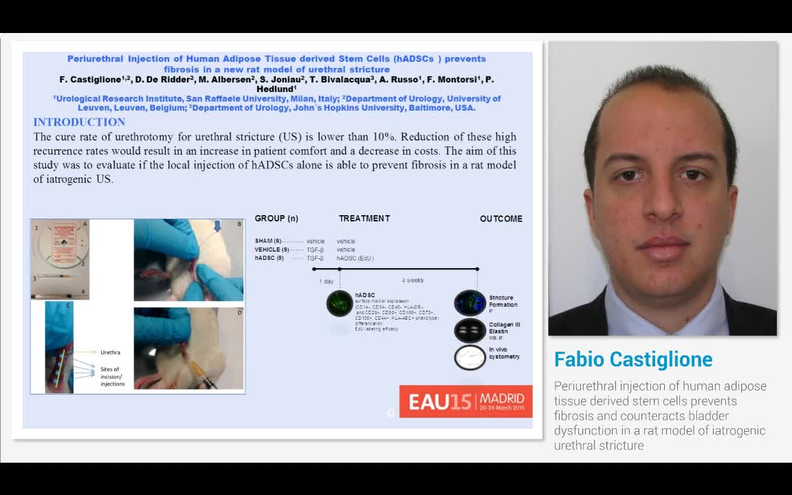 Periurethral injection of human adipose tissue derived st..-