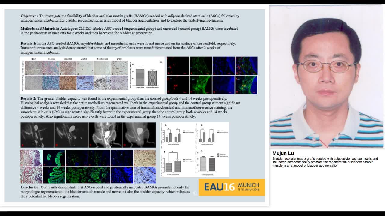 Bladder acellular matrix grafts seeded with adipose-deriv-