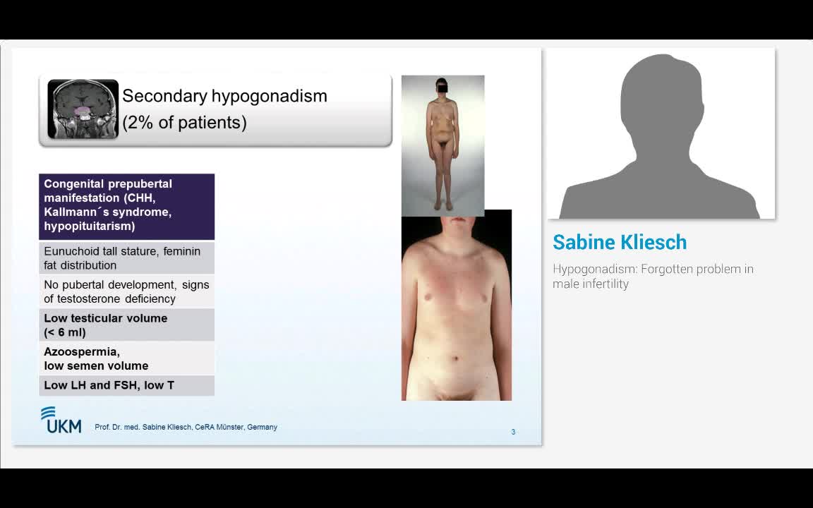 Hypogonadis, Forgotten problem in male infertility