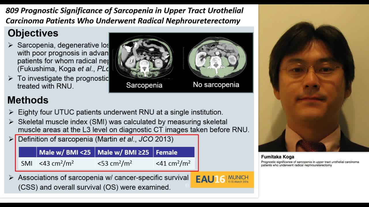 Prognostic significance of sarcopenia in upper tract urot-