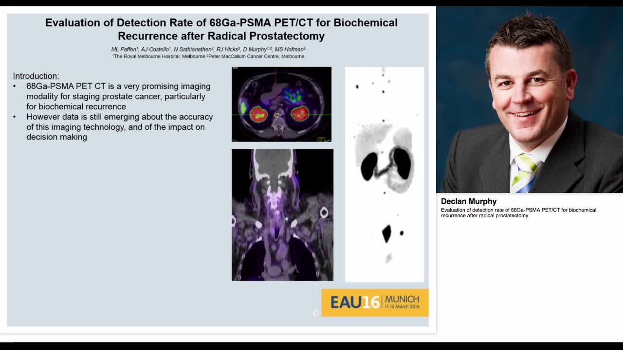 Evaluation of detection rate of 68Ga-PSMA PET-CT for bioc-