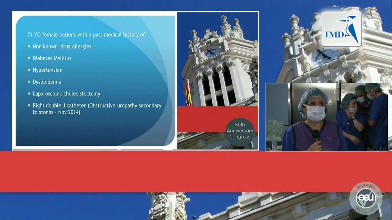 微创经皮肾镜取石术中的新理念（1）