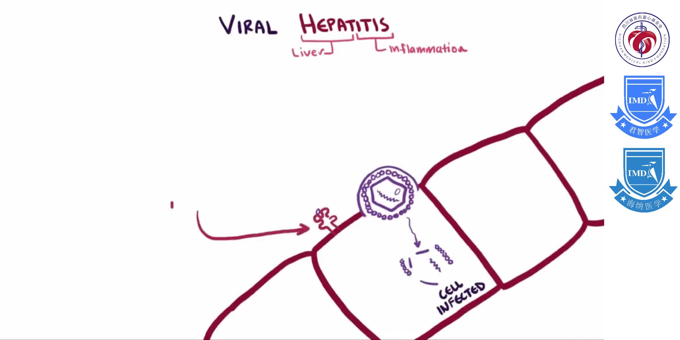 Viral hepatitis (A, B, C, D, E) - causes, symptoms, diagnosis, treatment & pathology_01