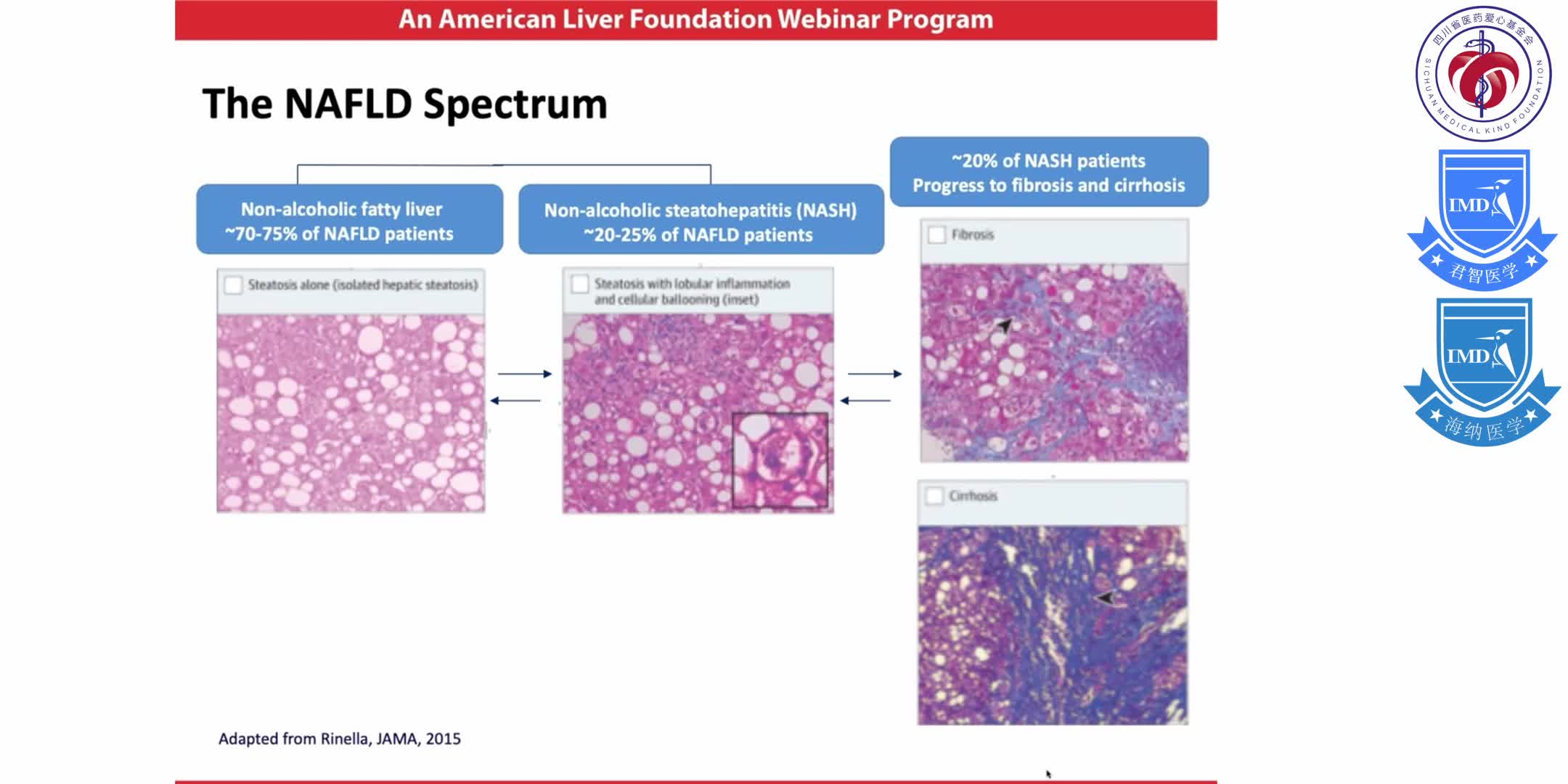 Ask the Experts Webinar  Updates in Management of Chronic Liver Disease  1-10