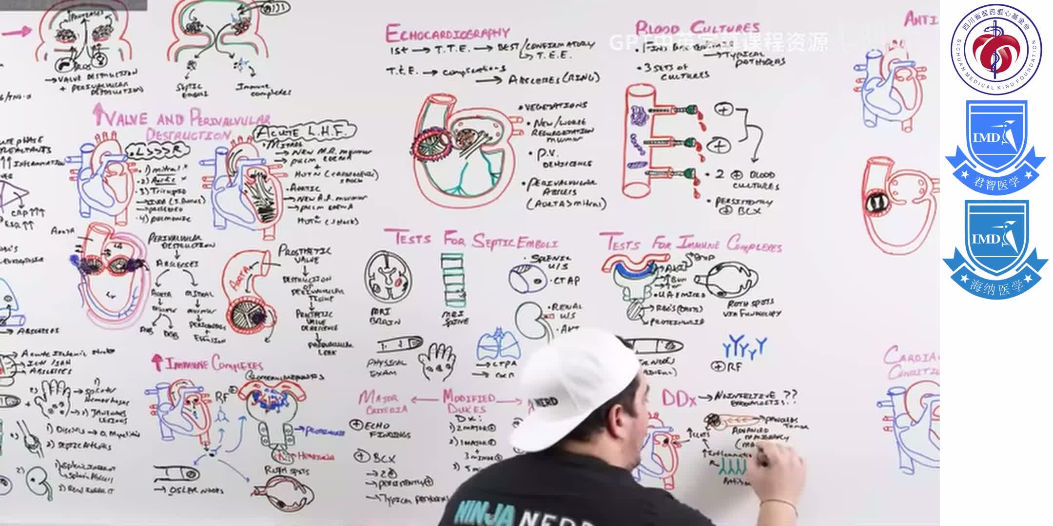 Infective Endocarditis 10