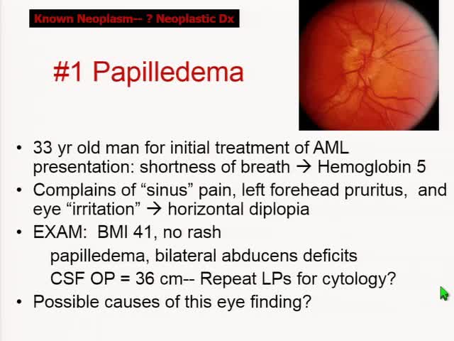 Case Studies in Metastatic Cancer