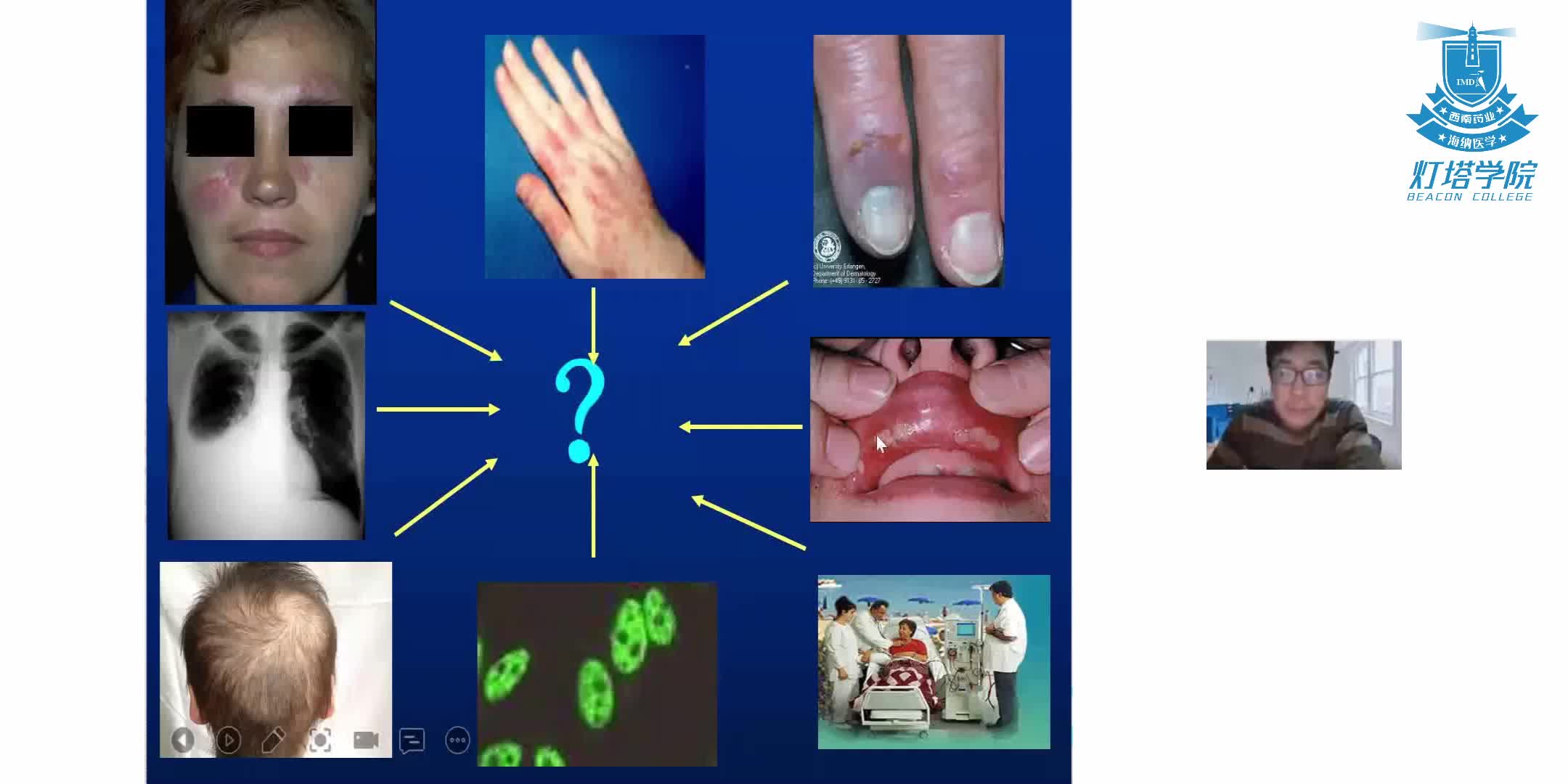 风湿病诊治的最新进展和诊断