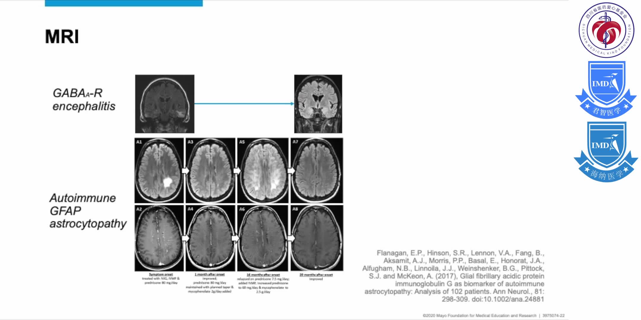 presents a summary of autoimmune central nervous system (CNS) disorders 11
