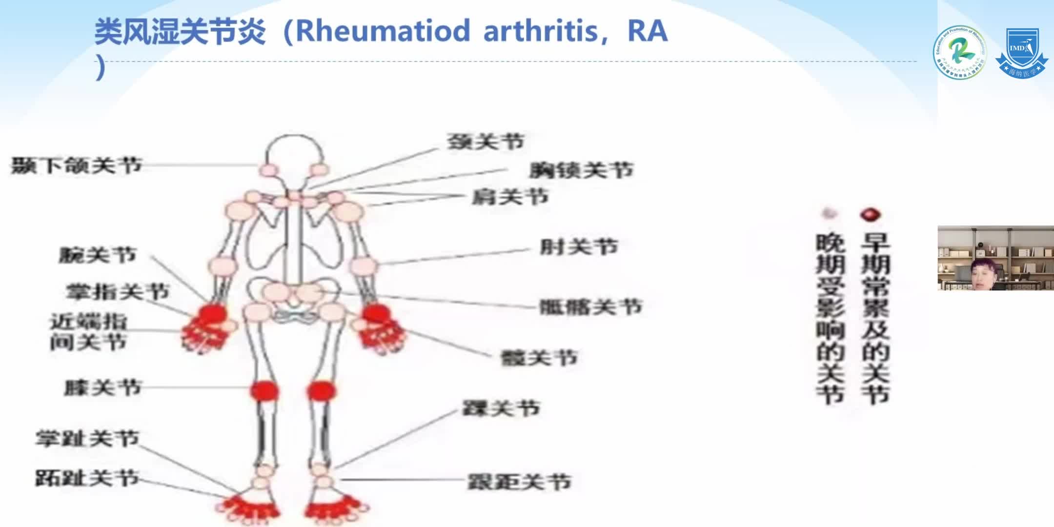 四川县域风湿-何芳-关节炎的诊断（2）