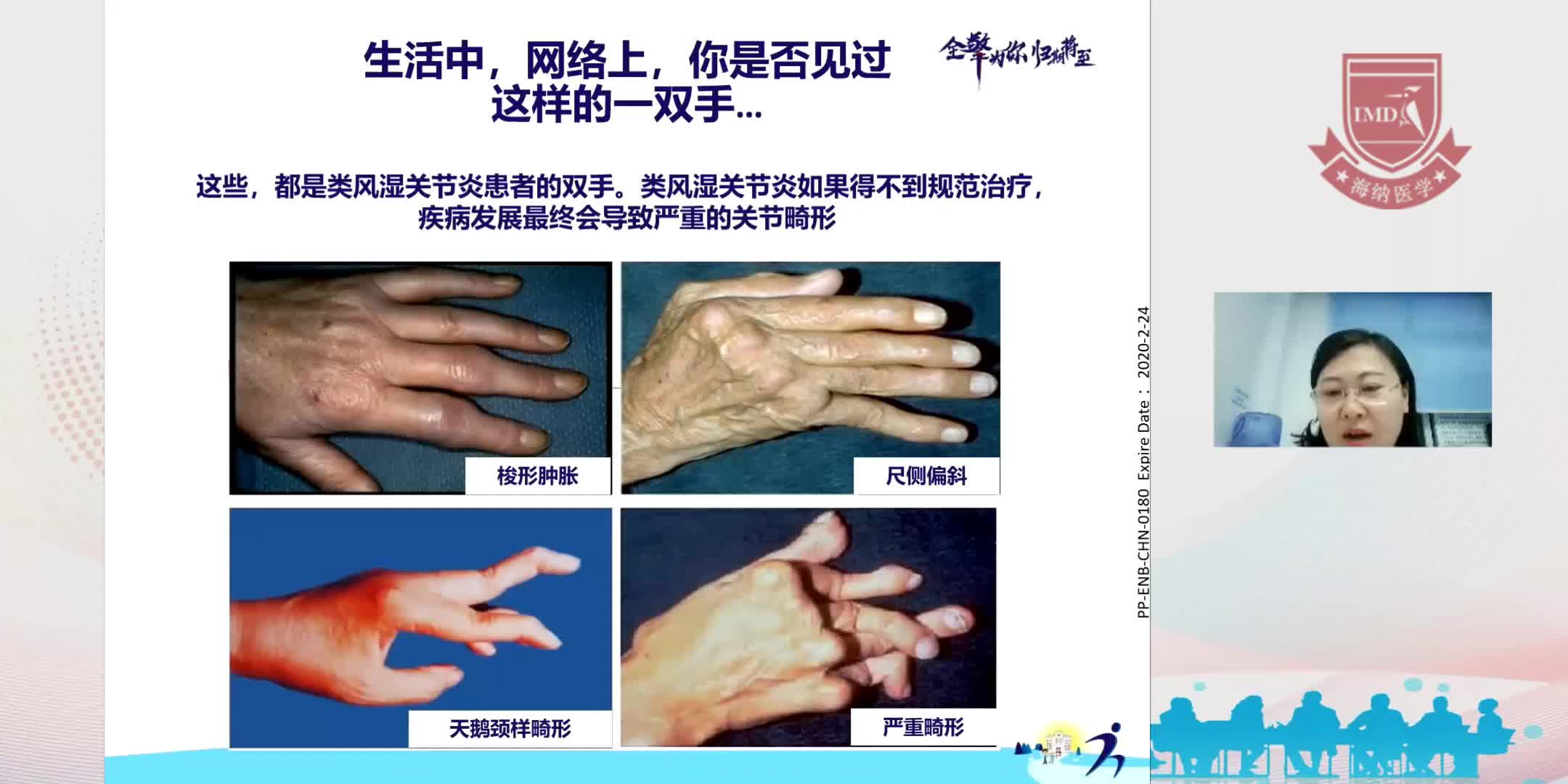 饶莉-类风湿关节炎疾病篇