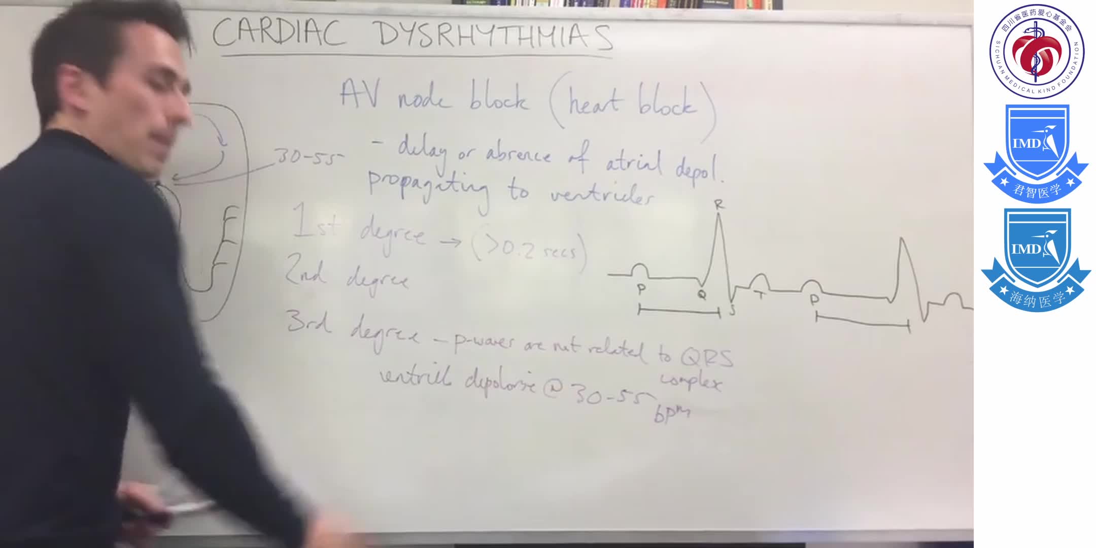 Cardiac dysrhythmias (arrhythmias) 8