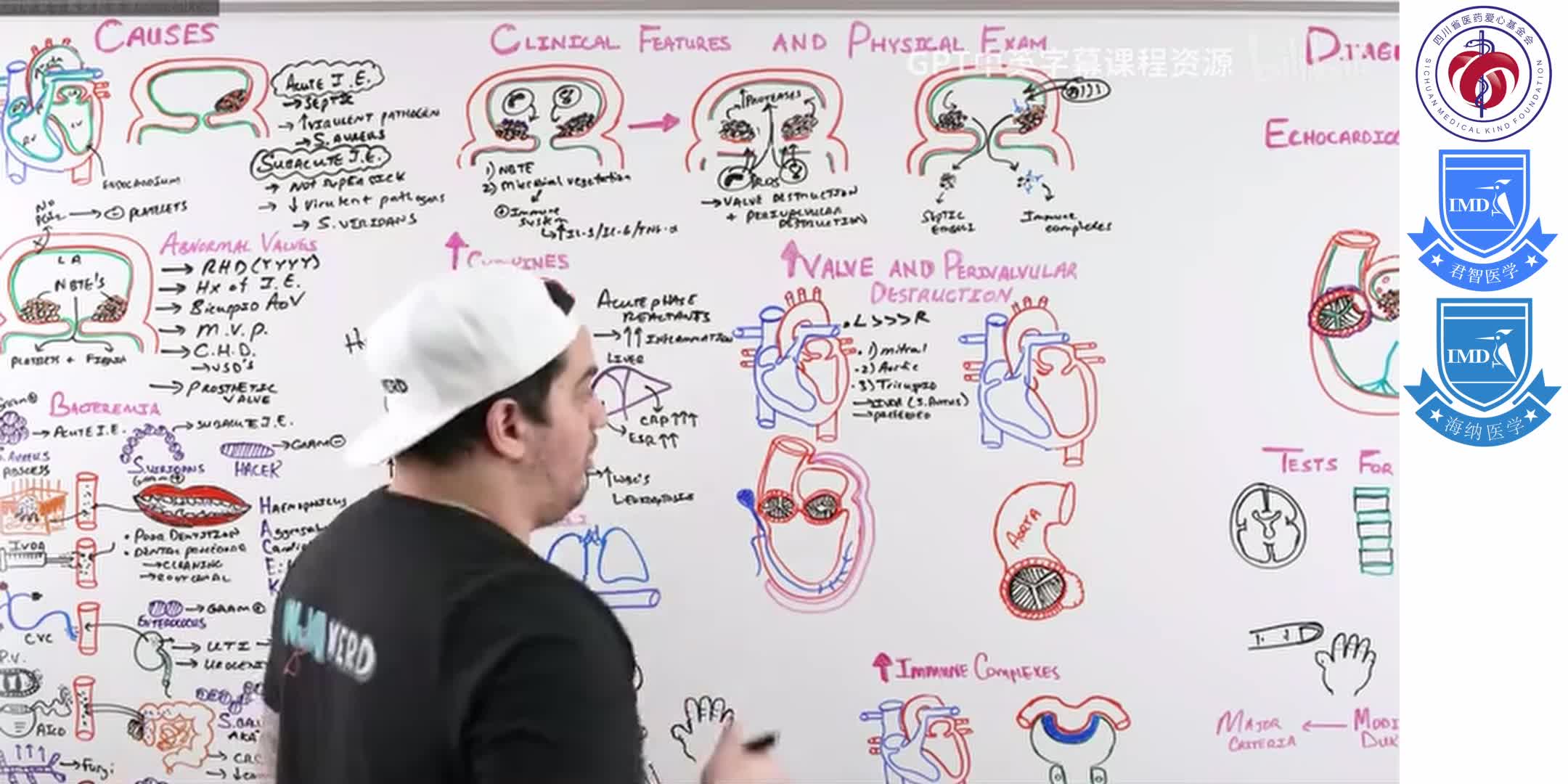 Infective Endocarditis 5