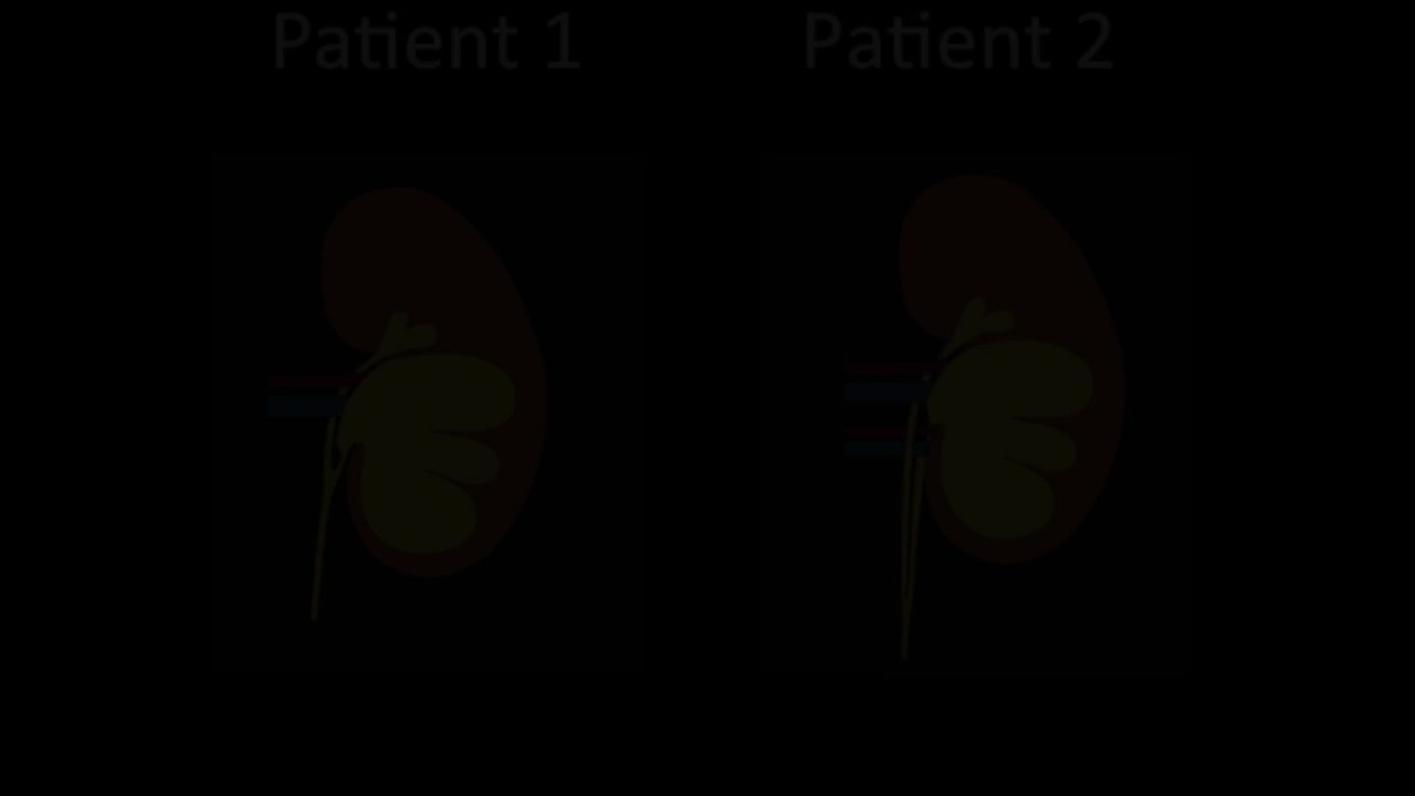 Robotic-assisted laparoscopic pyeloplasty for lower pole ..-