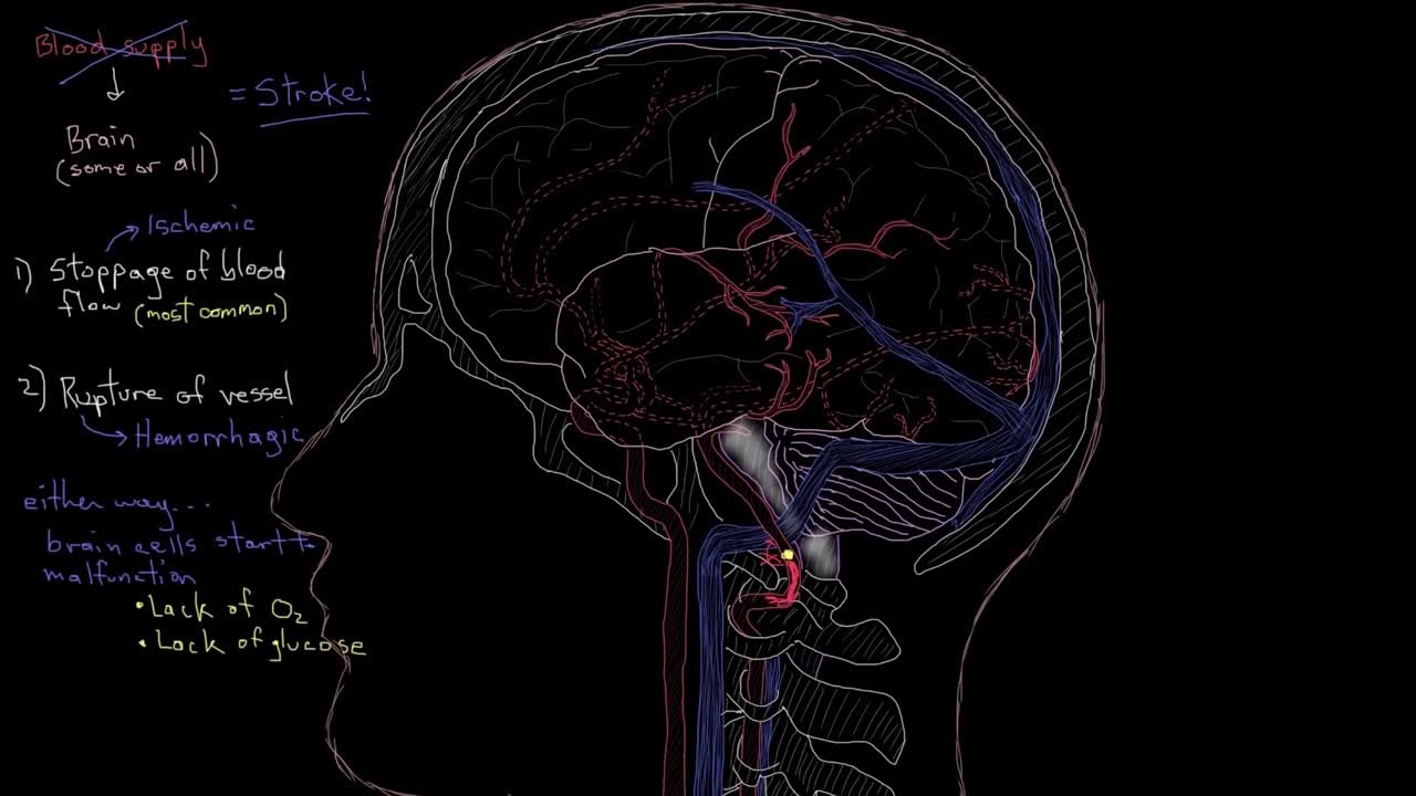 中风后大脑结构示意动画（2）