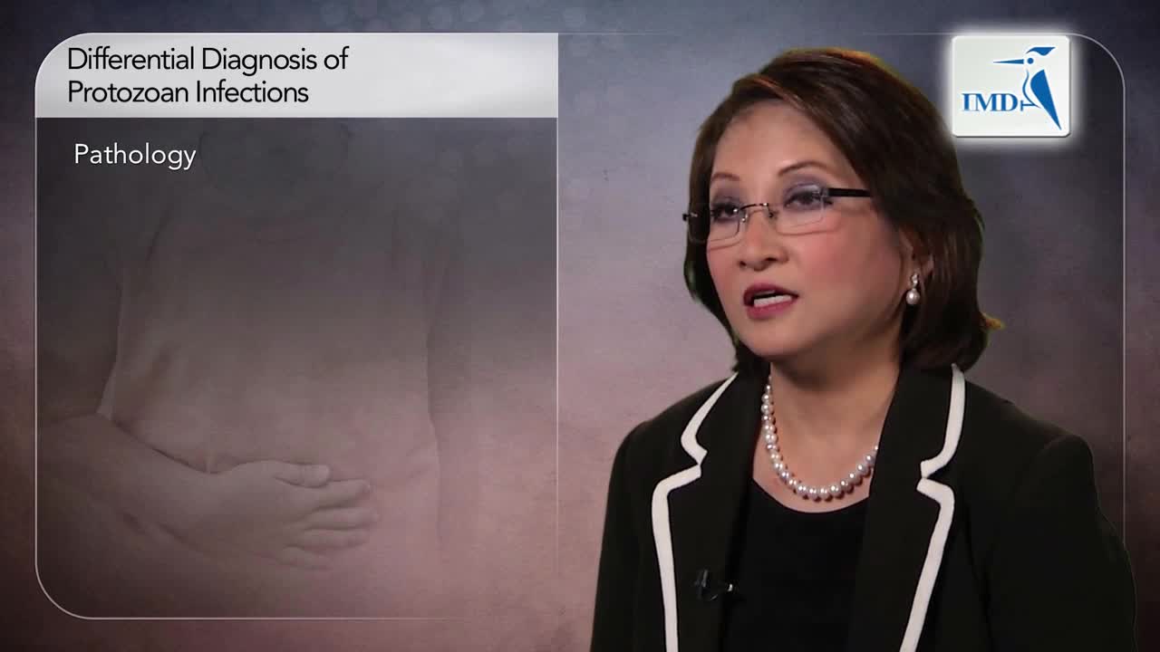 原虫感染性腹泻的鉴别诊断（2）