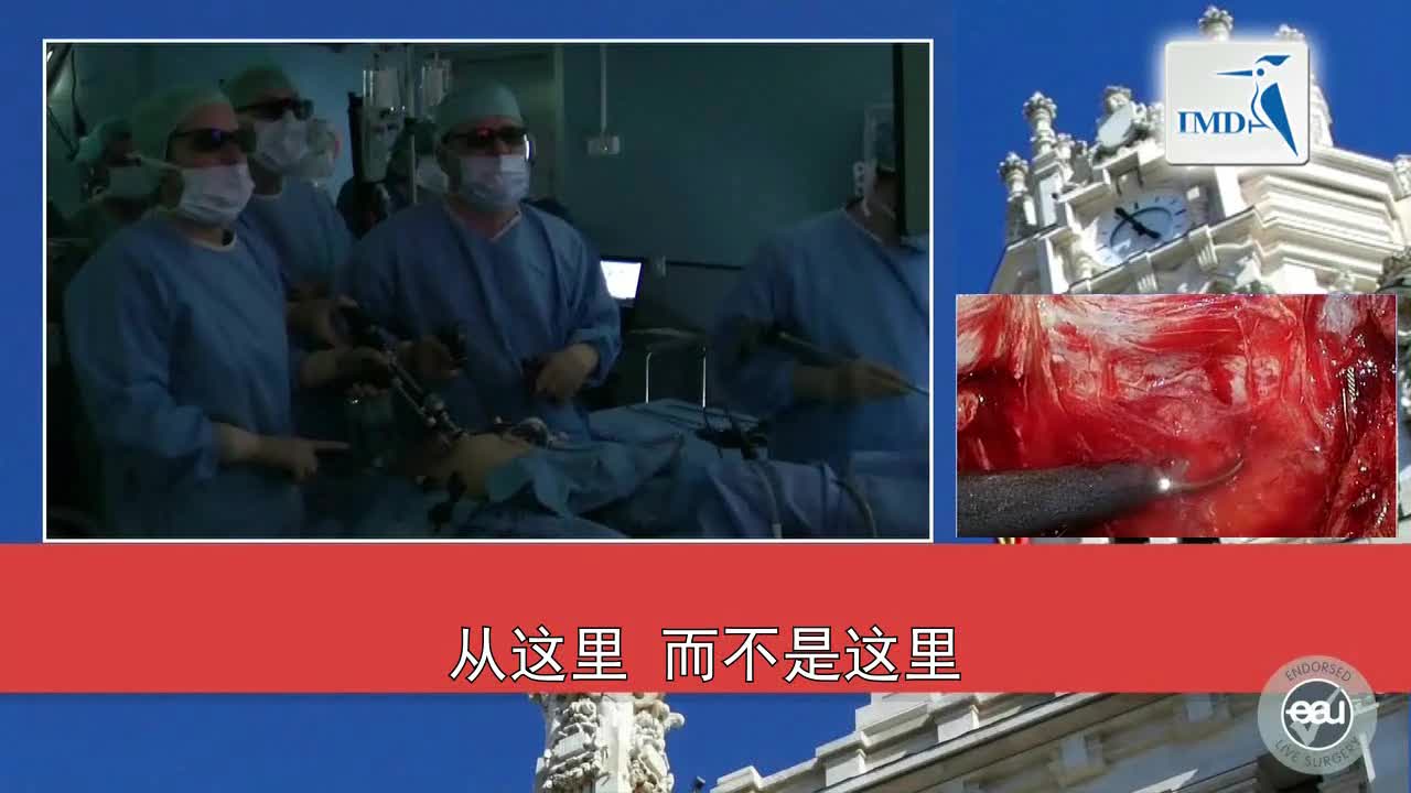 3D腹腔镜腹膜外根治性前列腺切除手术（3）