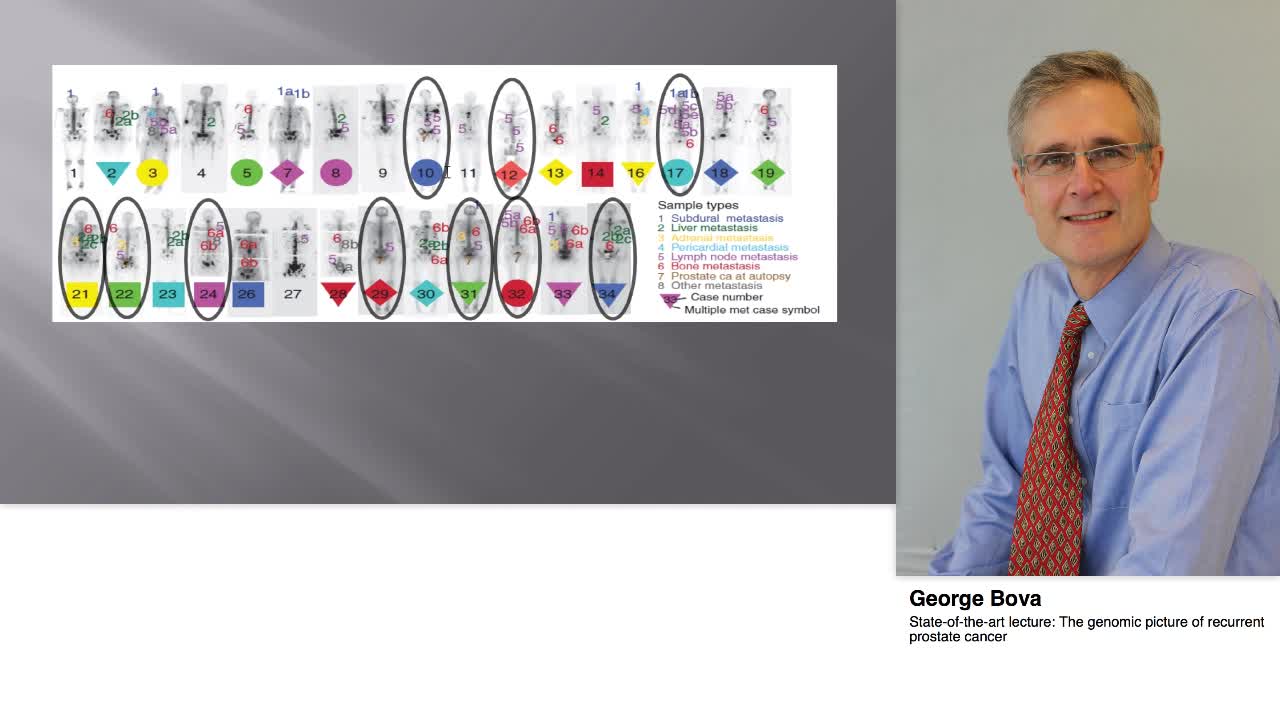 The genomic picture of recurrent prostate cancer
