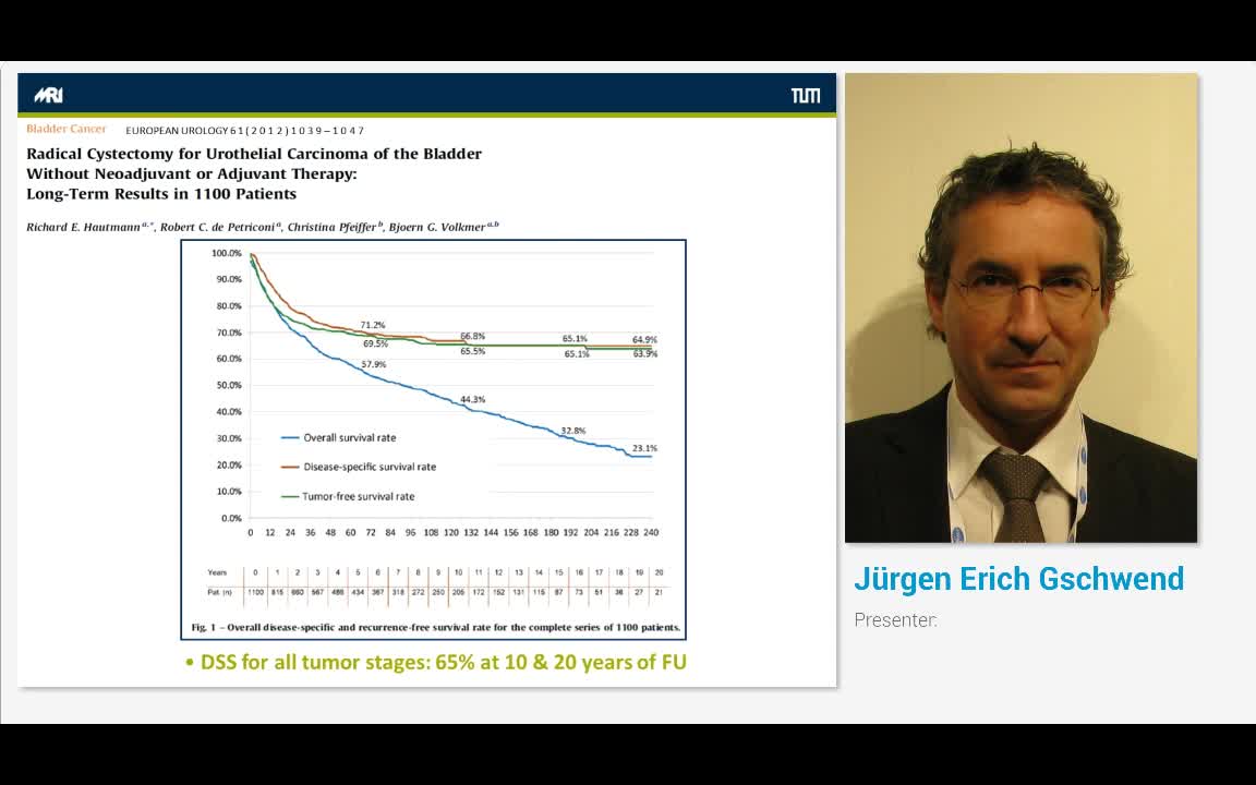 Extended lymph node dissection in bladder cancer - What i..-