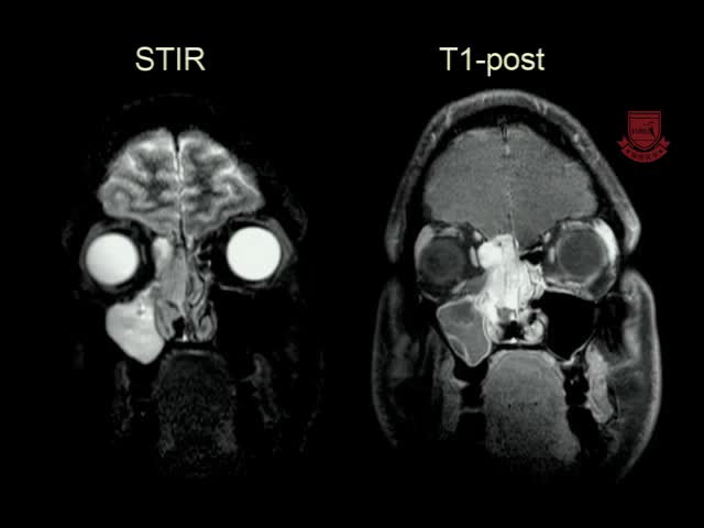 基于案例的神经影像学方法3