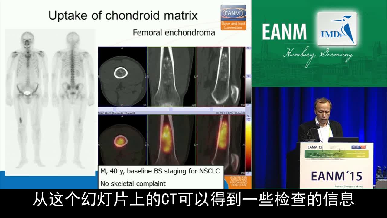 软骨瘤多模态影像挑战（预告）