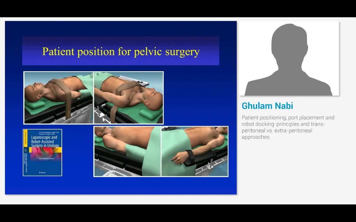 Patient positioning, port placement and robot docking-pri..-