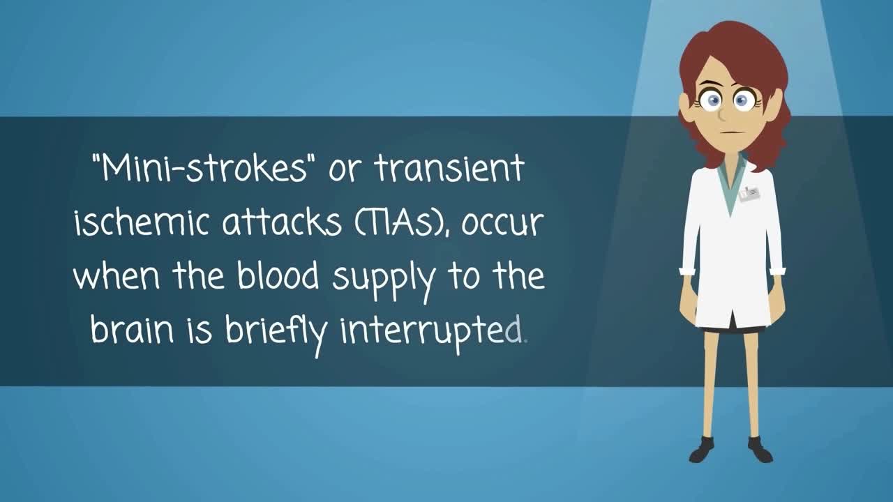 脑卒中的病因症状和治疗