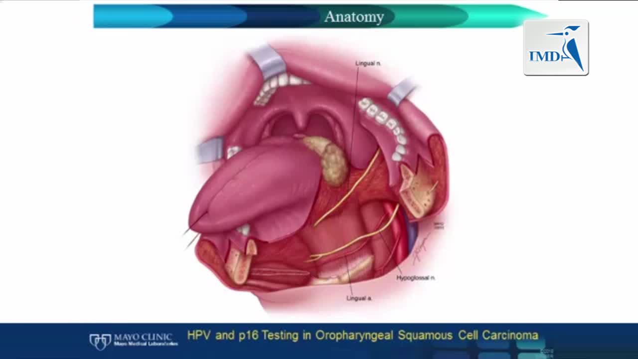 人乳突瘤病毒及鳞状上皮细胞癌p16检测（2）