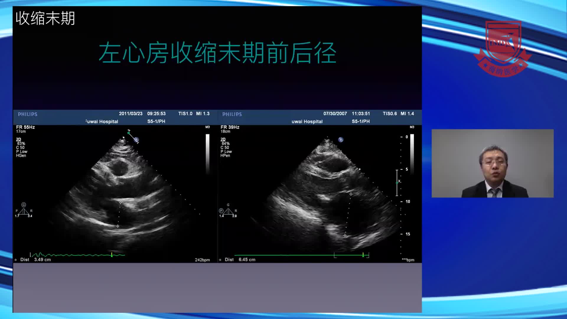 按部就班，我能行！--经胸超声心动图切面解读--段福建2