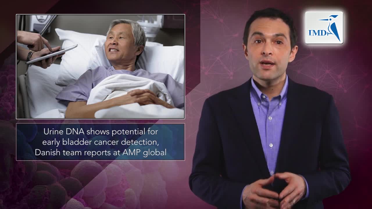 全新DNA检测提前从膀胱癌患者尿液中发现突变基因