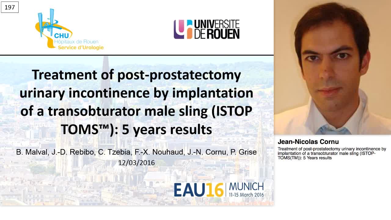 Treatment of post-prostatectomy urinary incontinence by i-