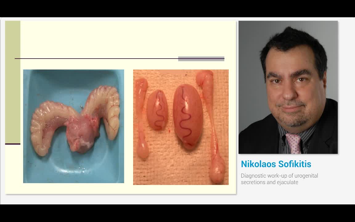 Diagnostic work-up of urogenital secretions and ejaculate