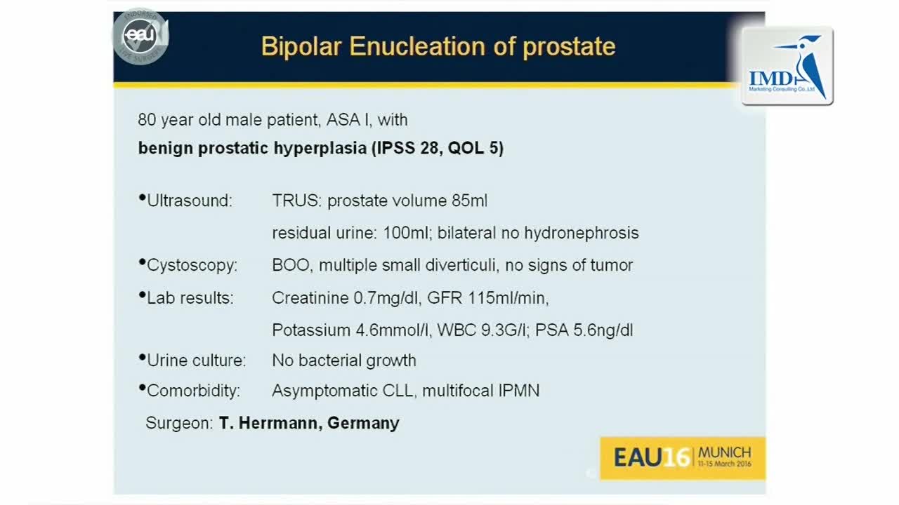 经尿道双极前列腺剜除术（1）