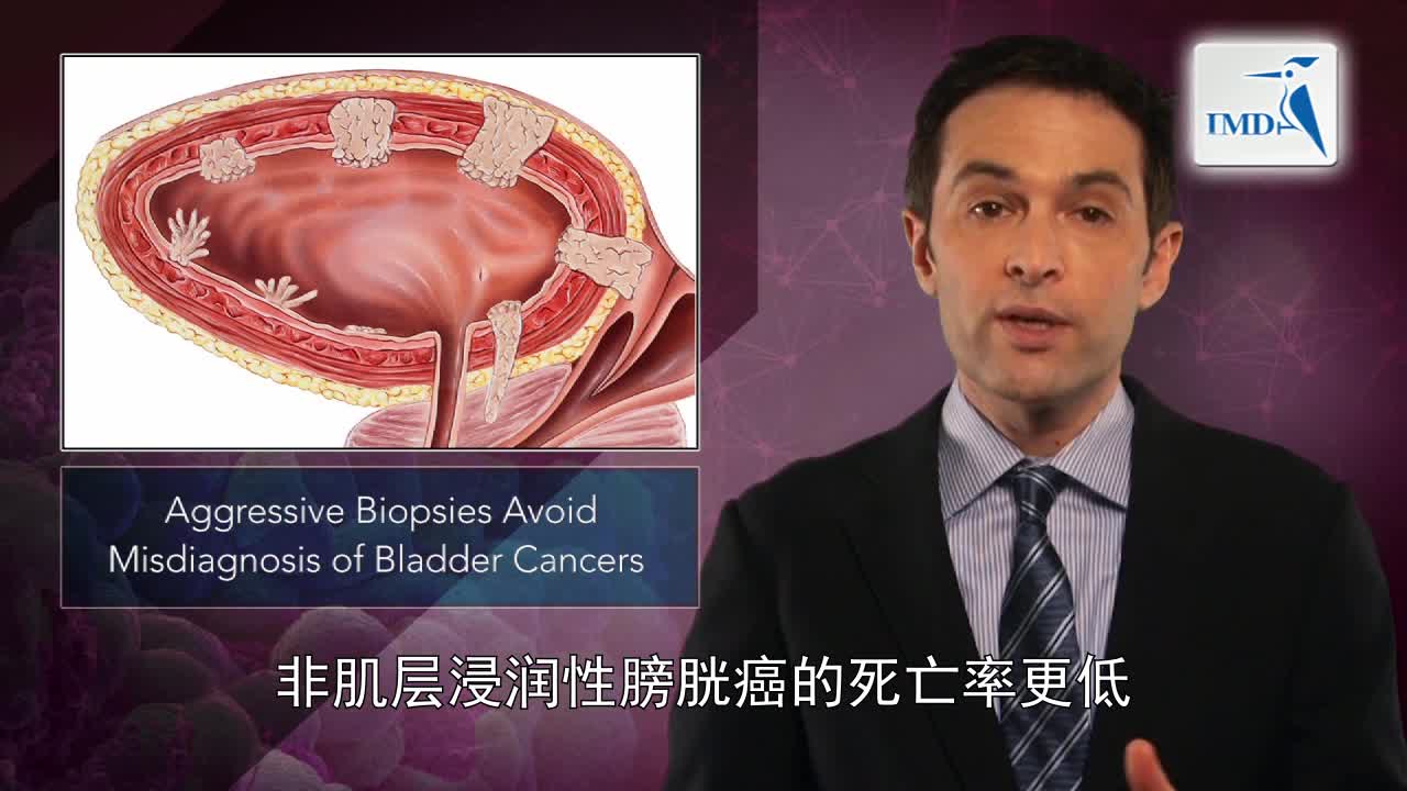 膀胱癌的精准分期对提高疗效至关重要