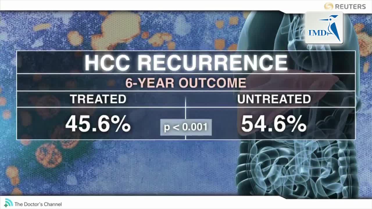 佐剂核苷类似物可以减少乙肝相关肝癌复发