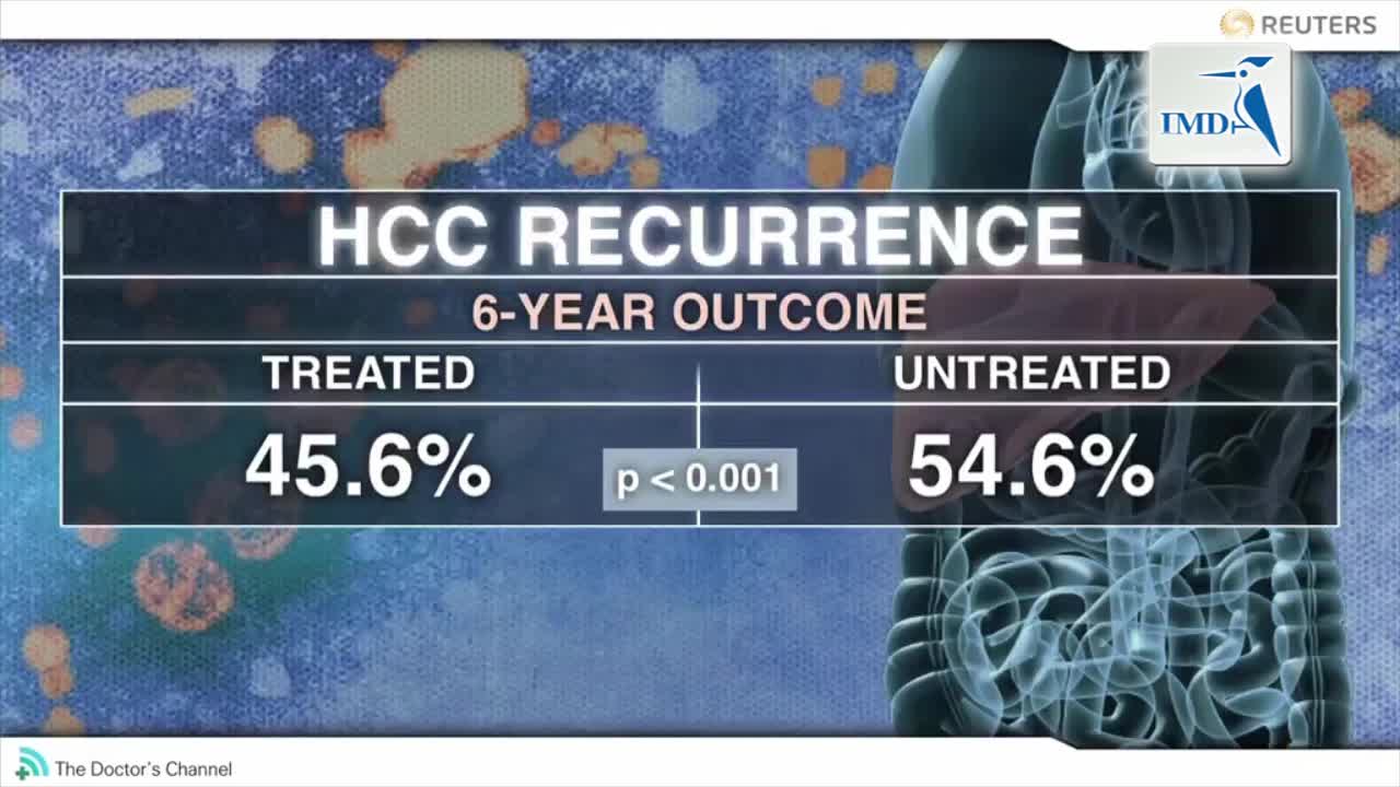 佐剂核苷类似物可以减少乙肝相关的肝癌复发