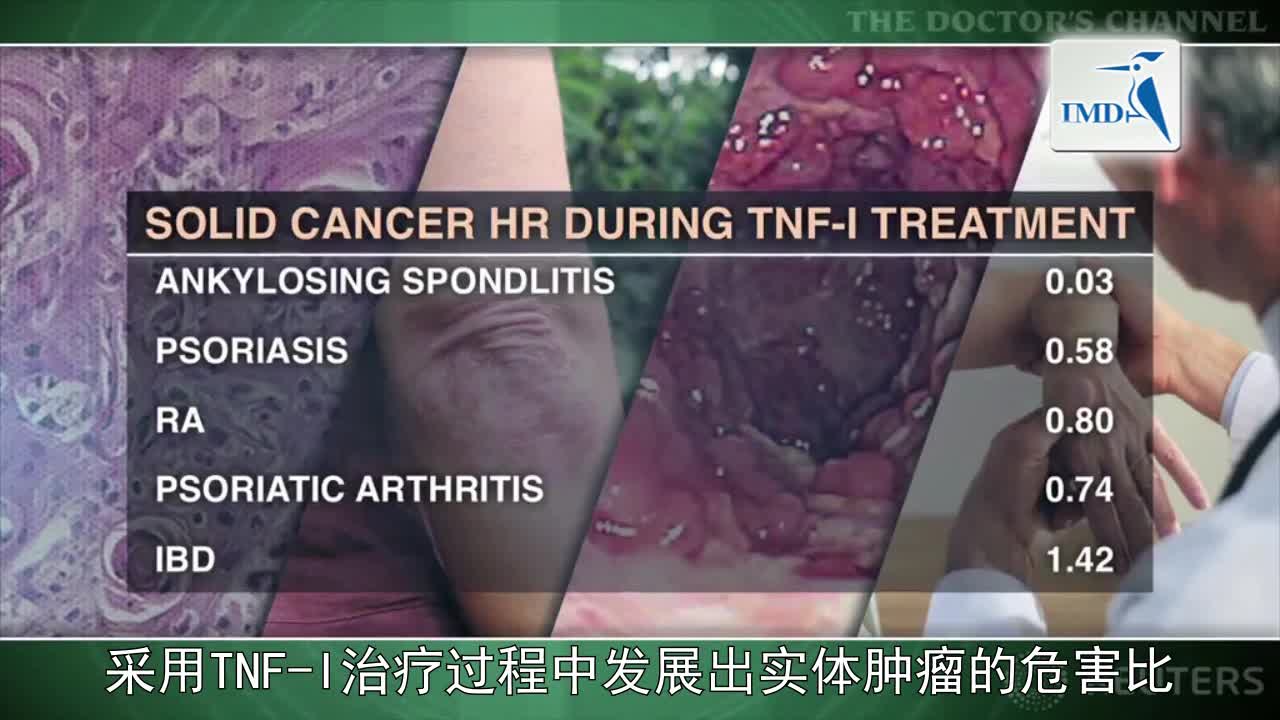 TNF抑制剂致癌风险的更多可靠发现