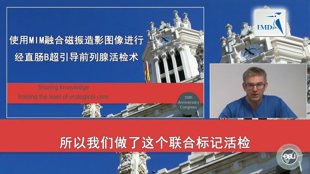 经直肠B超引导前列腺活检术（1）