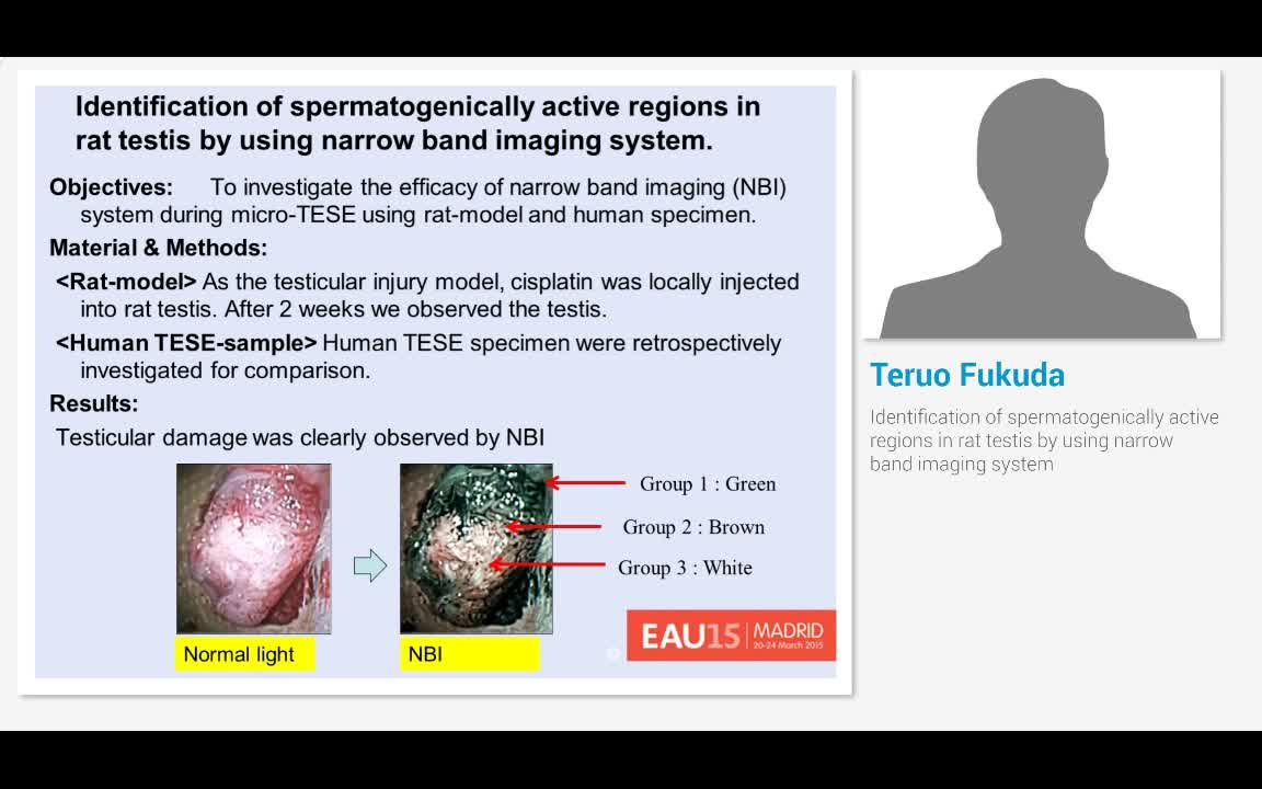 Identification of spermatogenically active regions in rat..-