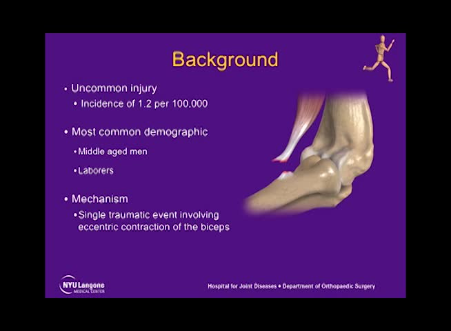 Distal Biceps Tendon Rupture Repair and Reconstruction