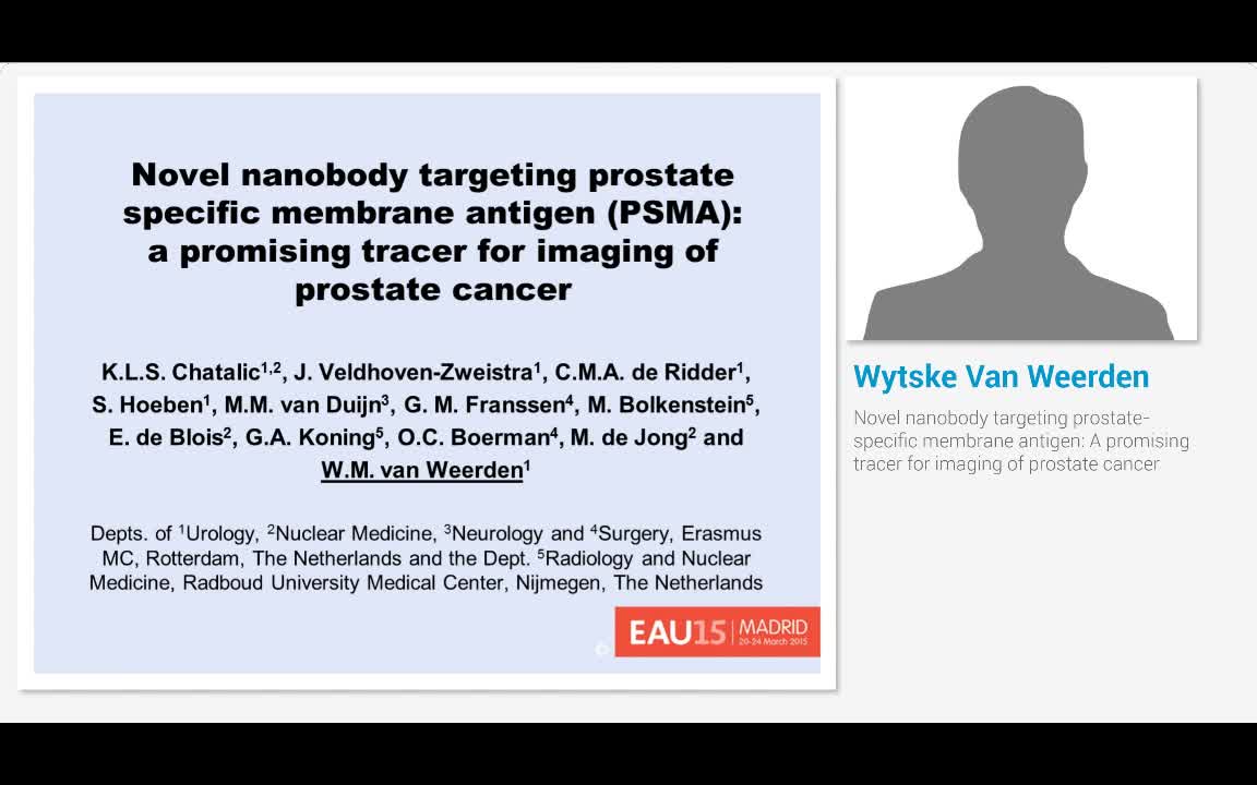 靶向前列腺特异性膜抗原的新型纳米抗体