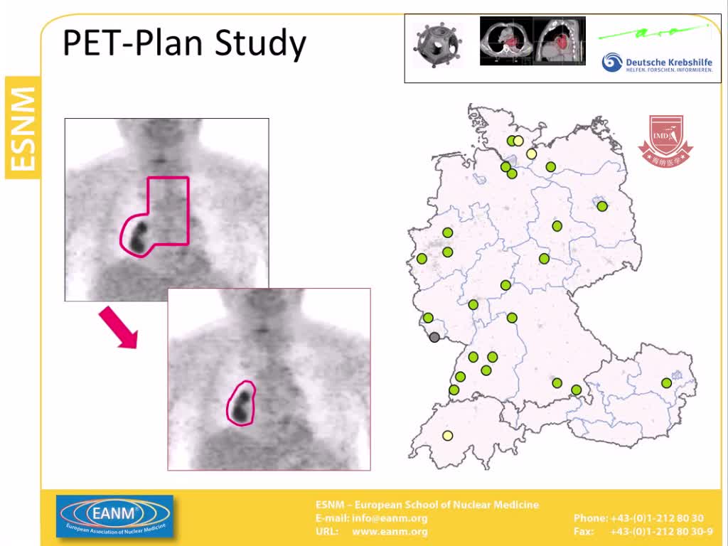 PET CT用于肺癌及其在放射治疗中的应用2