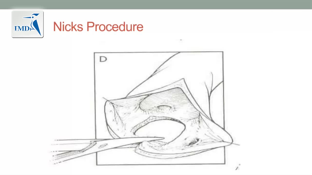 《胸外科》主动脉根部拓宽术和主动脉瓣重建术（2）