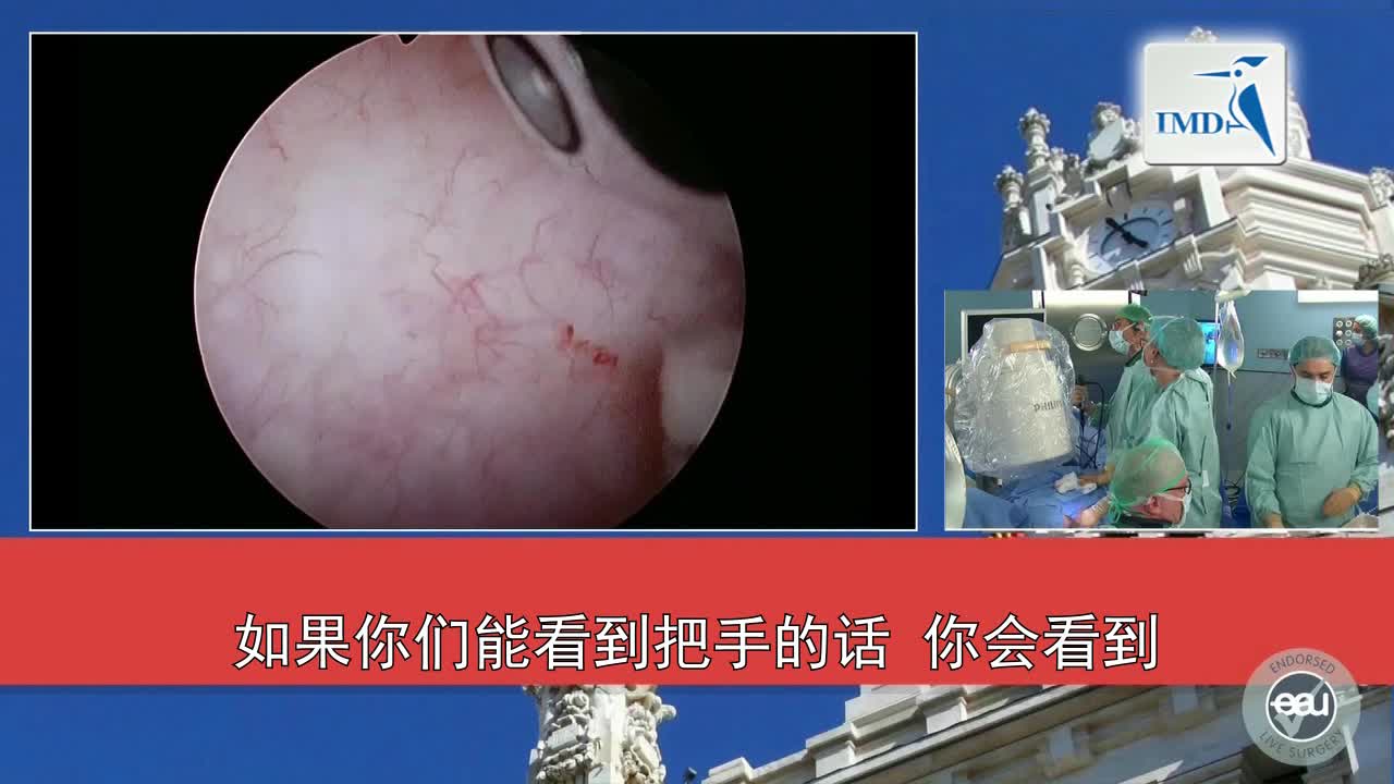 数字技术在肾结石手术中的运用（3）