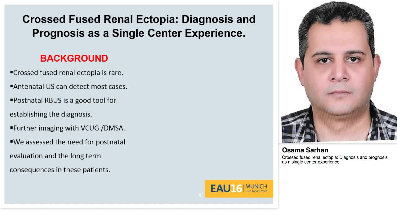 Crossed fused renal ectopia, Diagnosis and prognosis as a-