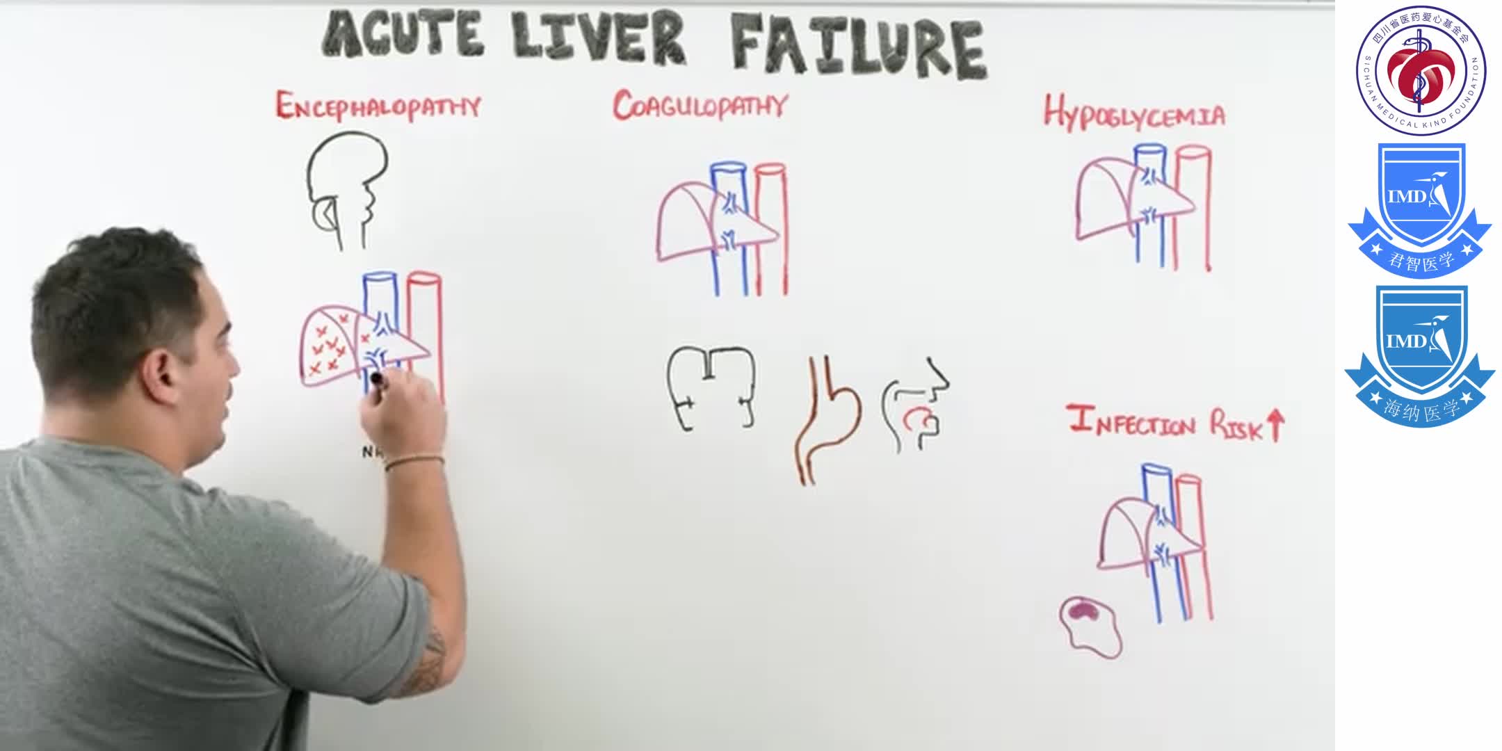 Acute Liver Failure 1-4