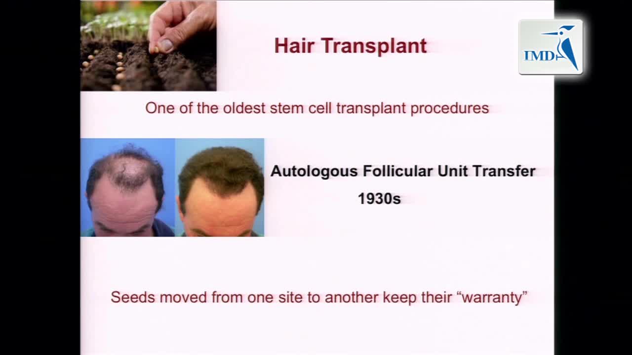 脱发的新兴治疗方法（8）