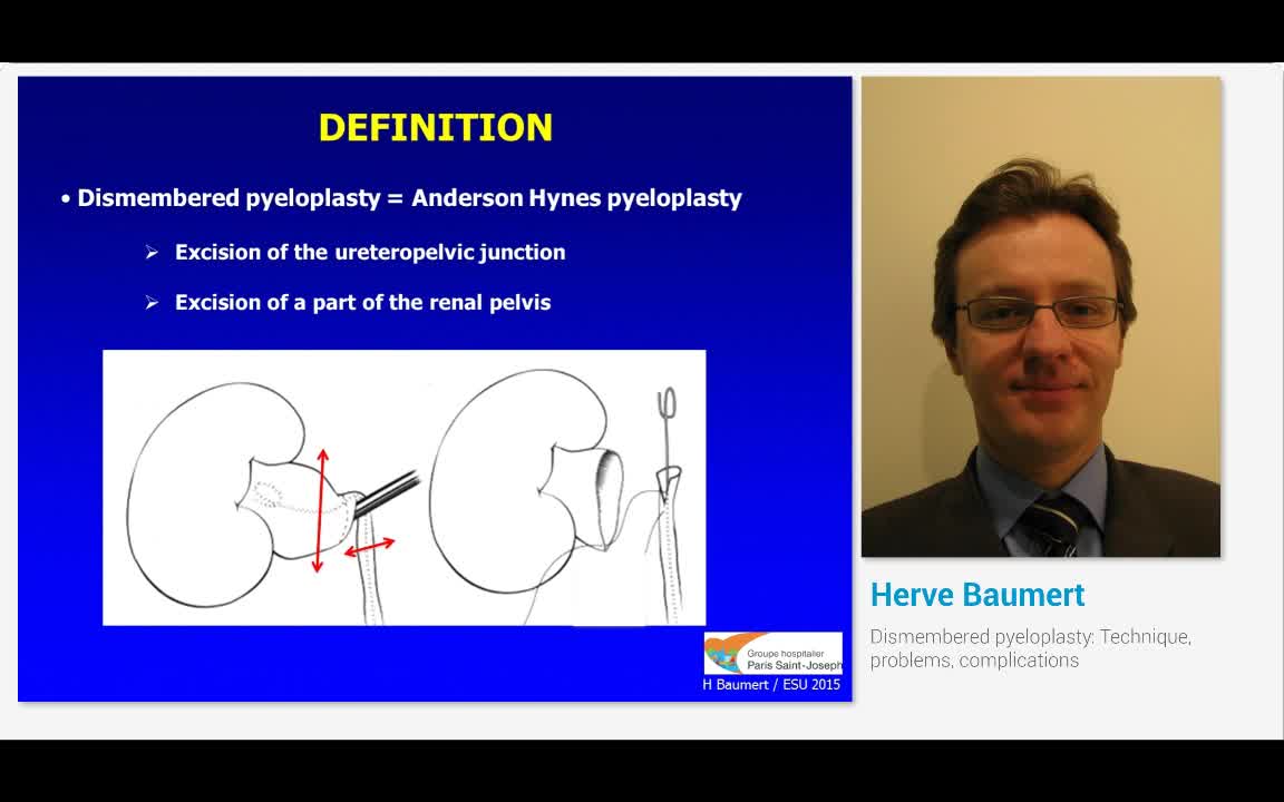 Dismembered pyeloplasty, Technique, problems, complications