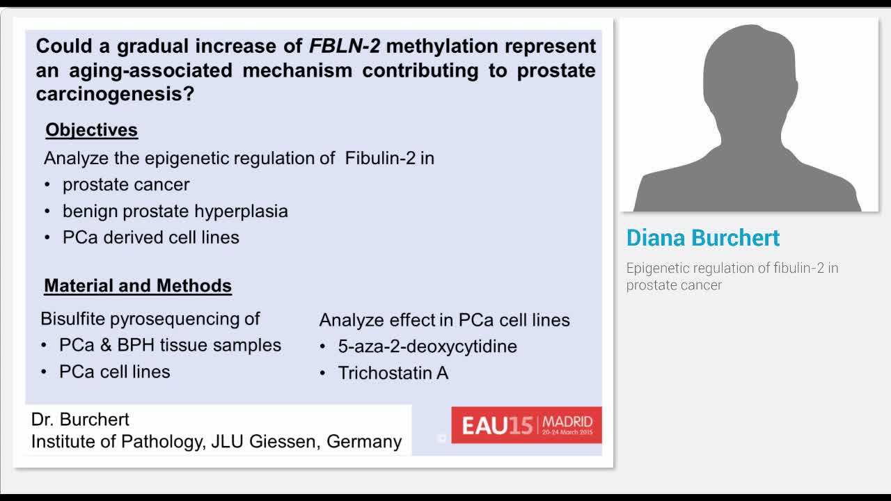 Epigenetic regulation of fibulin-2 in prostate cancer