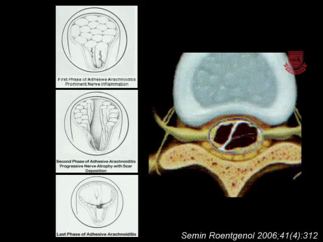 基于案例的神经影像学方法4